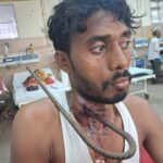 इंदौर एमवाय अस्पताल के डॉक्टरों ने फिर किया कमालगले में घुसे सरिए के बावजूद युवक की बची जान